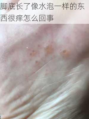 脚底长了像水泡一样的东西很痒怎么回事